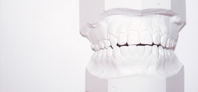 wax model of teeth