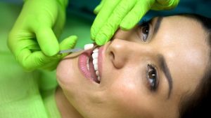 woman getting a porcelain veneer placed on her tooth